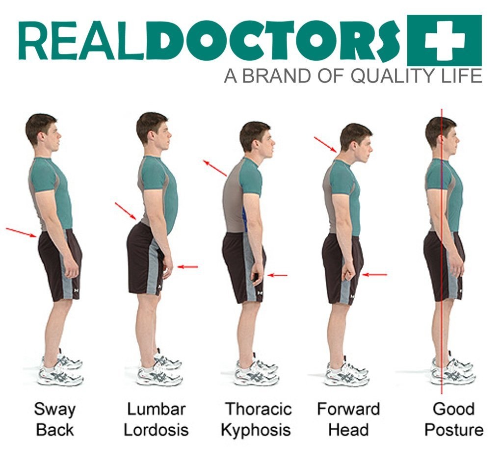 spondylolisthesis back brace