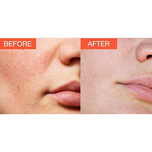 biobare vitamin c serum sephora